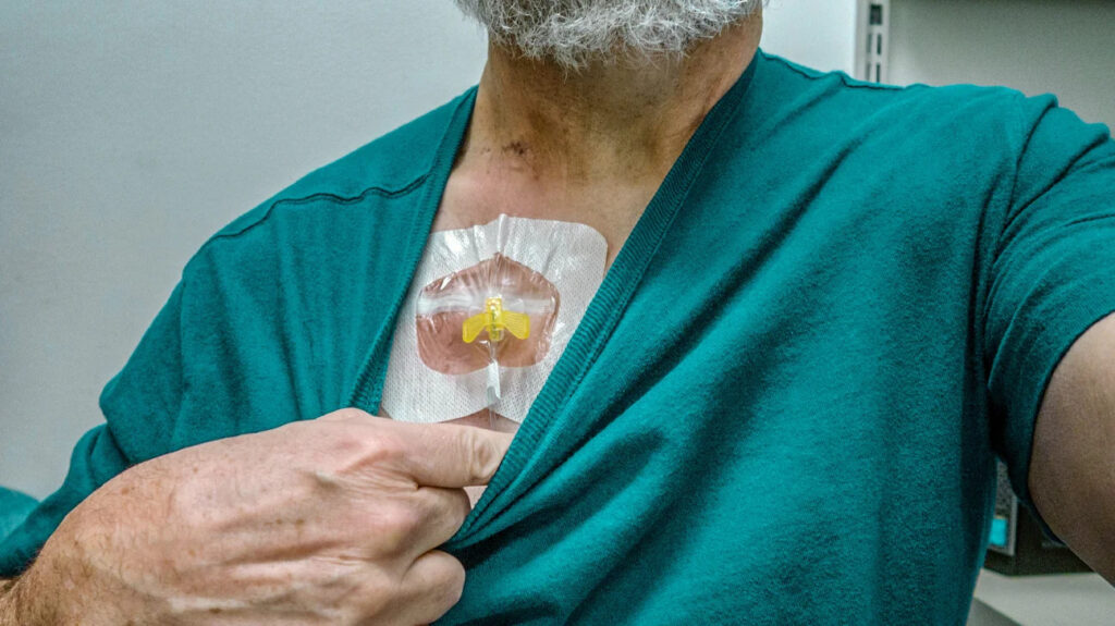 Chemo-Port Handling at home